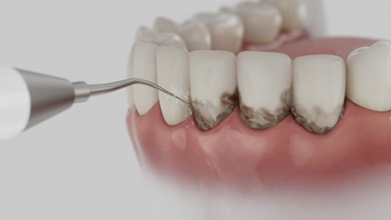 Reliable Dental Implants contractor in Palestine, IL by Smile Center Dentistry